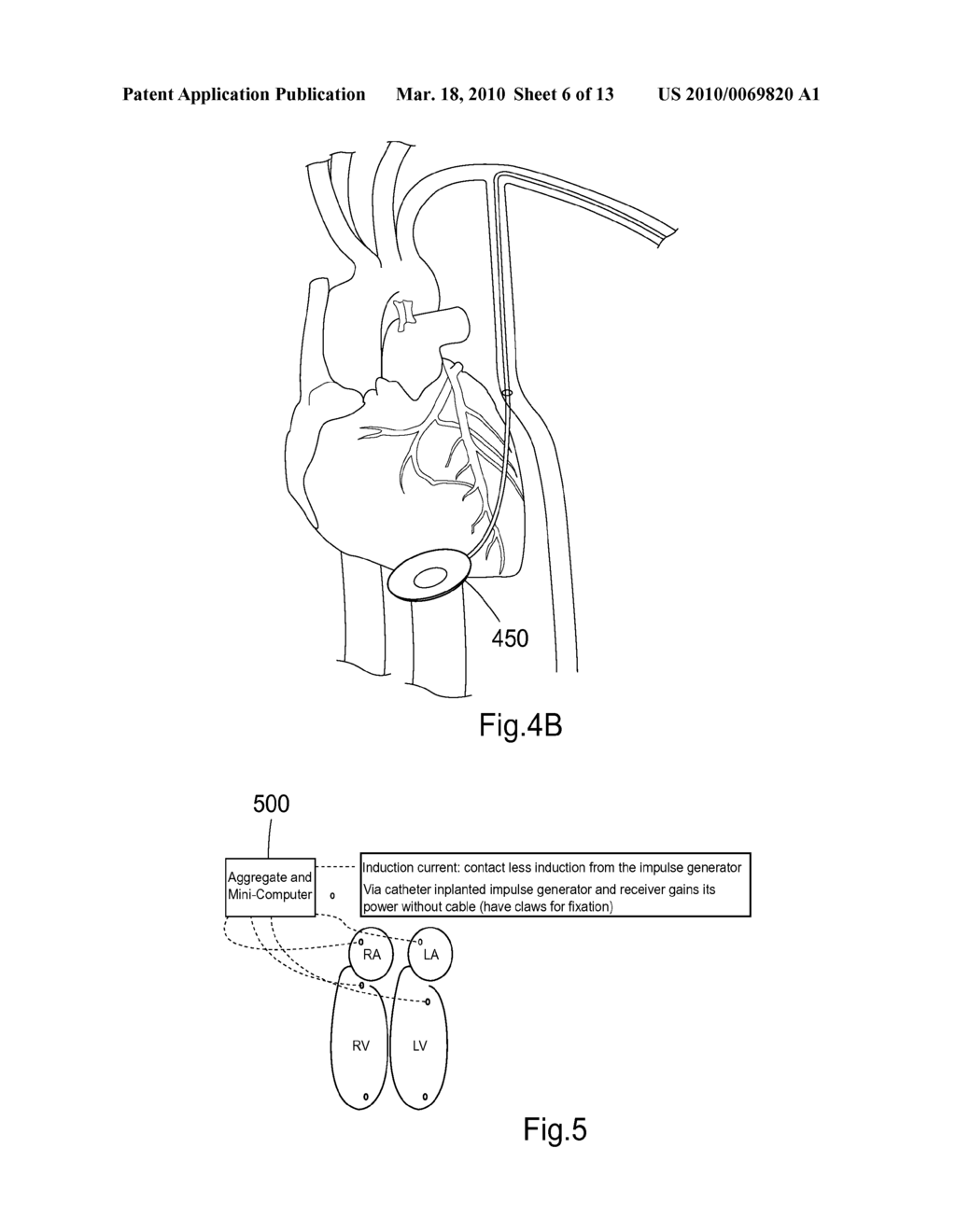 DEVICE, SYSTEM, KIT, AND METHOD FOR EPICARDIAL ACCESS - diagram, schematic, and image 07