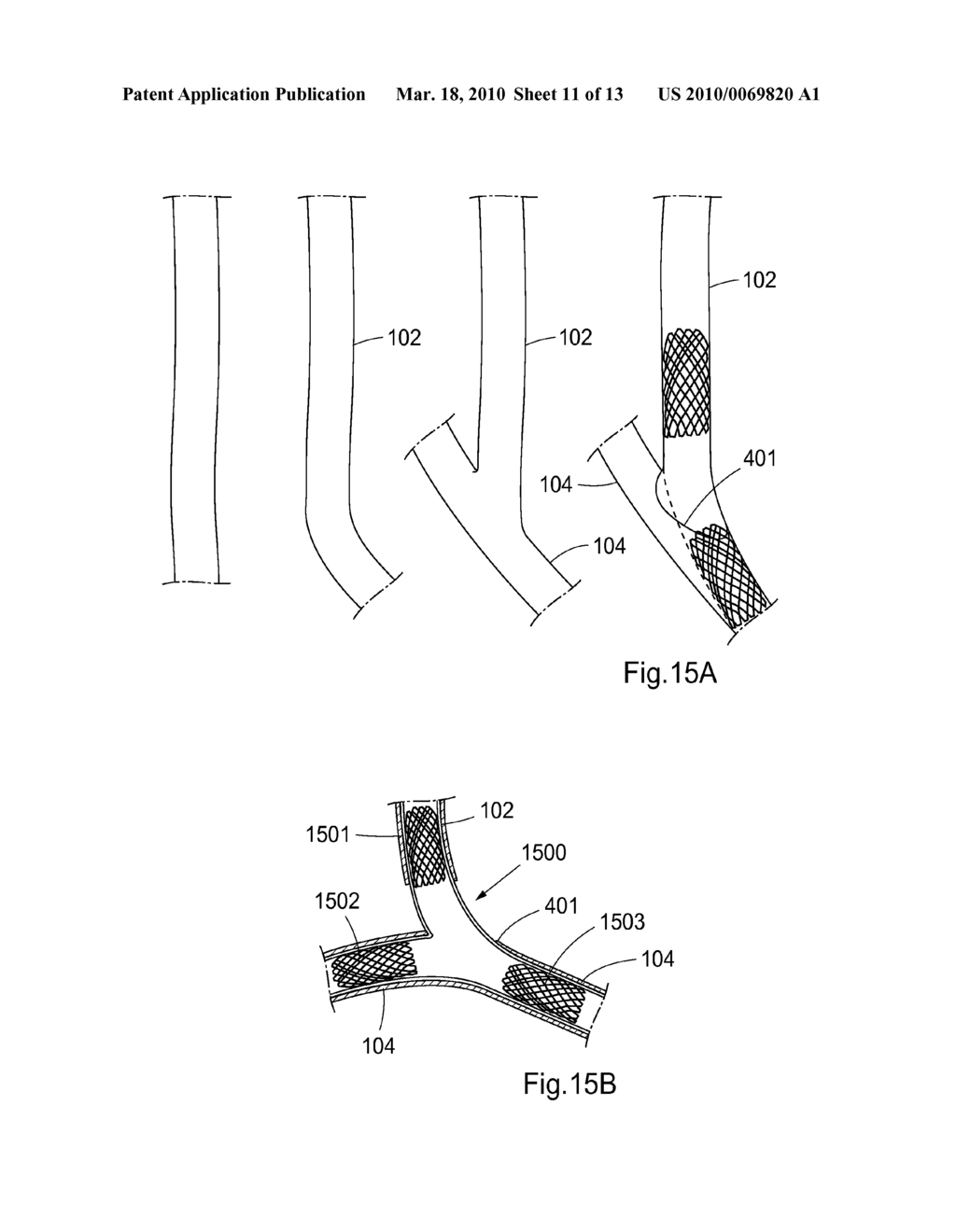 DEVICE, SYSTEM, KIT, AND METHOD FOR EPICARDIAL ACCESS - diagram, schematic, and image 12