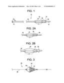 PLAQUE LIBERATING DEVICE diagram and image