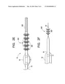 PLAQUE LIBERATING DEVICE diagram and image