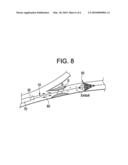 PLAQUE LIBERATING DEVICE diagram and image