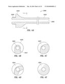 SYSTEMS AND METHODS FOR TRANSVERSE PHACOEMULSIFICATION diagram and image