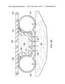 THERAPY DELIVERY SYSTEMS AND METHODS diagram and image