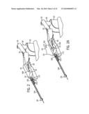 CATHETER SYSTEM diagram and image