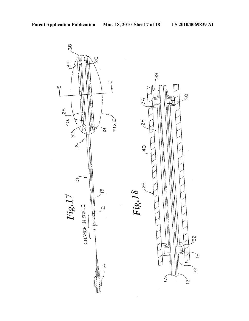 Catheter with Removable Balloon Protector and Stent Delivery System With Removable Stent Protector - diagram, schematic, and image 08