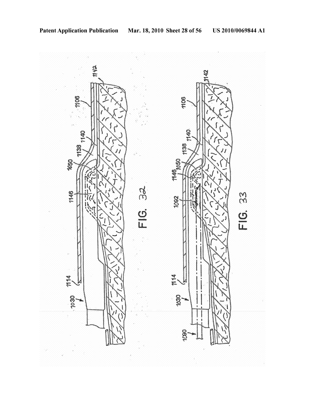 Devices and Methods for Interstitial Injection of Biologic Agents into Tissue - diagram, schematic, and image 29