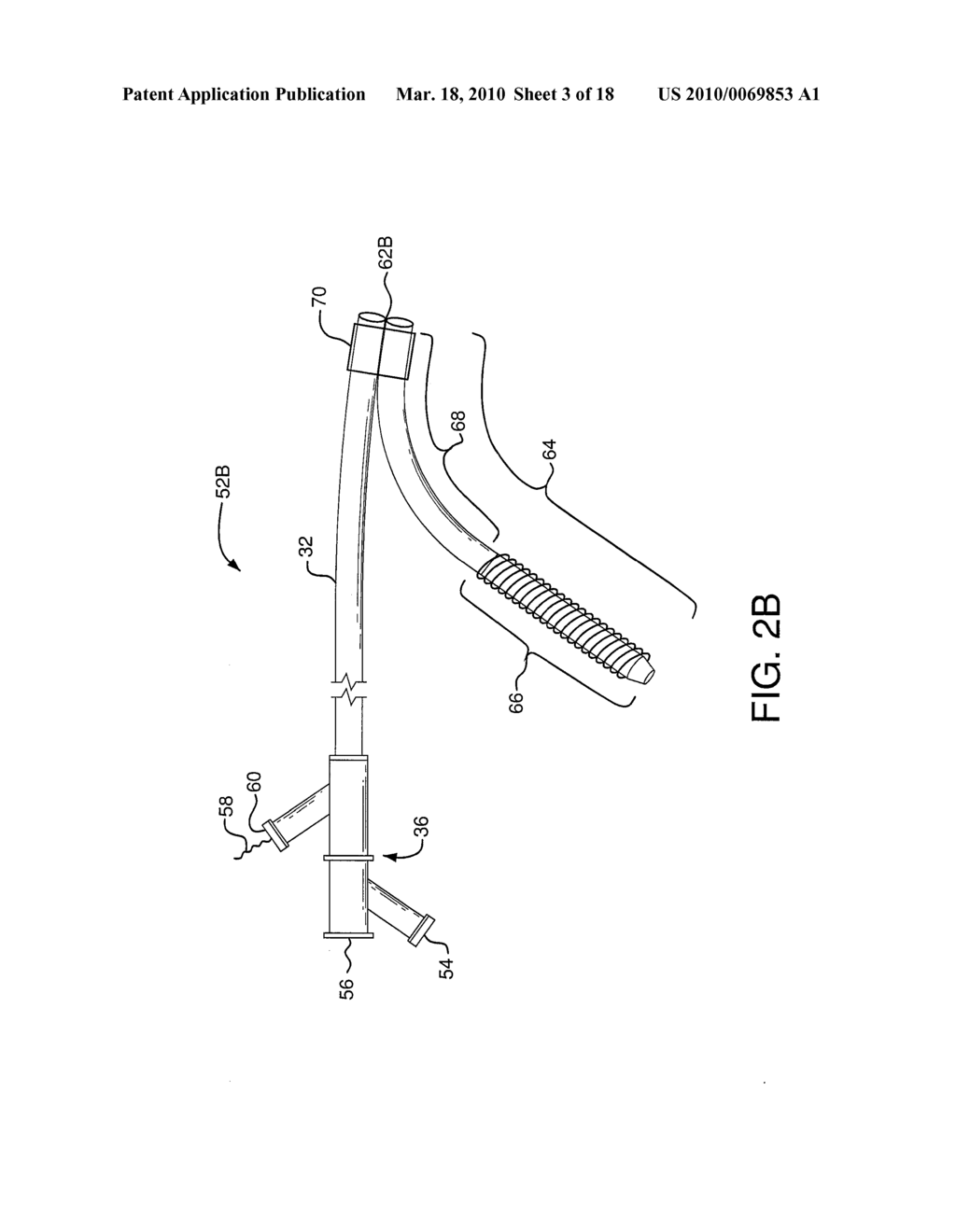 Branched Stent Delivery System - diagram, schematic, and image 04