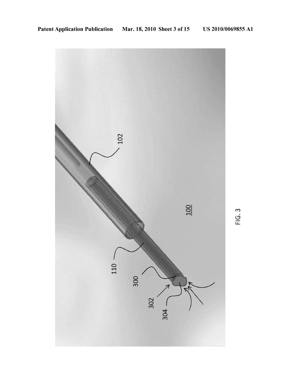 CLOG-PREVENTING VALVED CATHETER AND METHOD OF USING THE CATHETER - diagram, schematic, and image 04