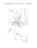 Osteotomy Guide and Method of Cutting the Medial Distal Tibia Employing the Same diagram and image