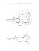 Osteotomy Guide and Method of Cutting the Medial Distal Tibia Employing the Same diagram and image