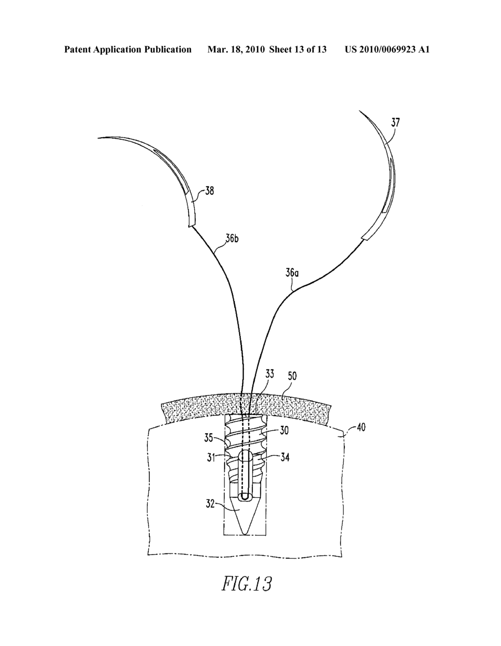 Suture Anchor Inserter - diagram, schematic, and image 14