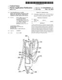 Transesophageal gastric reduction method and device for reducing the size of a previously formed gastric reduction pouch diagram and image