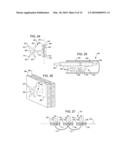 Transesophageal gastric reduction method and device for reducing the size of a previously formed gastric reduction pouch diagram and image