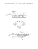 Transesophageal gastric reduction method and device for reducing the size of a previously formed gastric reduction pouch diagram and image