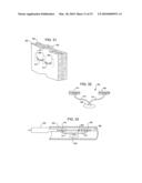 Transesophageal gastric reduction method and device for reducing the size of a previously formed gastric reduction pouch diagram and image