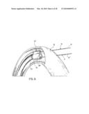 ANASTOMOTIC DEVICE diagram and image