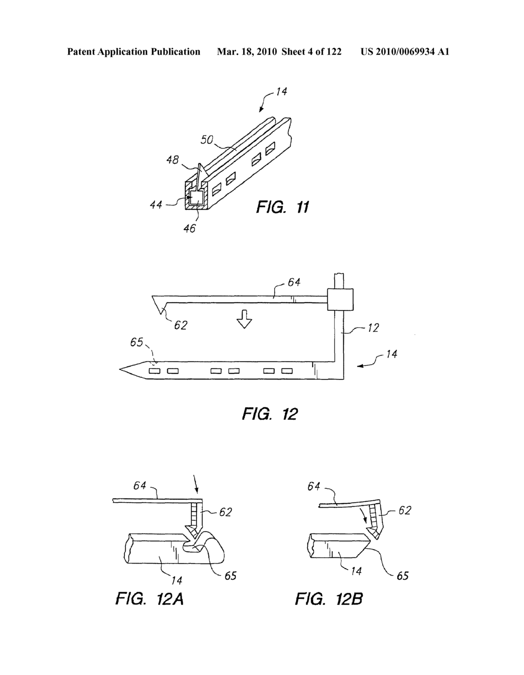 Anastomosis Method Utilizing Tool with Fluid-Driven Actuator - diagram, schematic, and image 05