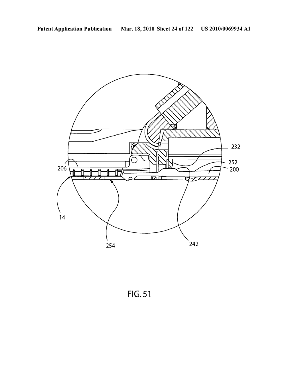 Anastomosis Method Utilizing Tool with Fluid-Driven Actuator - diagram, schematic, and image 25