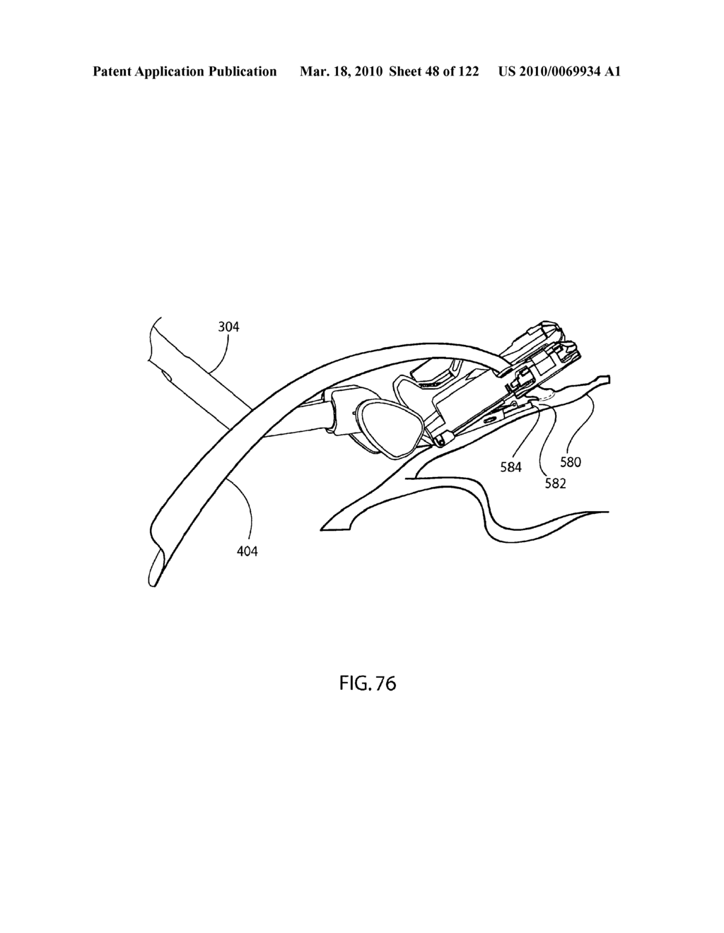 Anastomosis Method Utilizing Tool with Fluid-Driven Actuator - diagram, schematic, and image 49