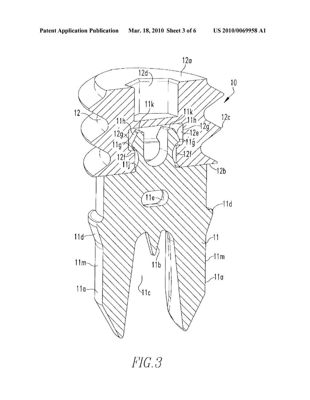 Tenodesis Implant - diagram, schematic, and image 04