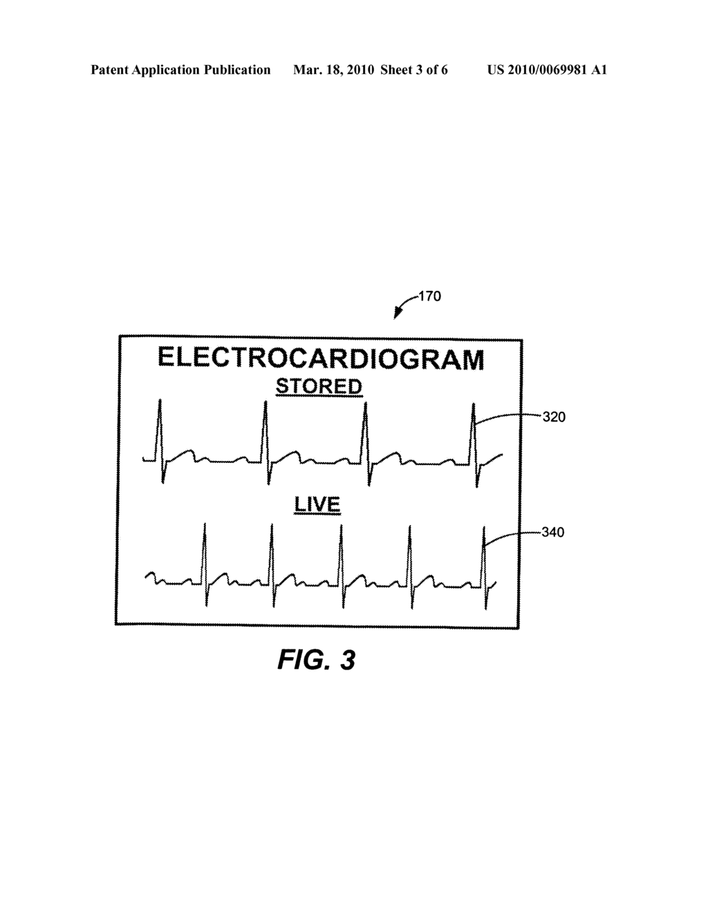 System and Method for Presenting Defibrillator Status Information While in Standby Mode - diagram, schematic, and image 04