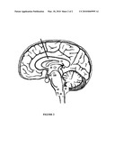 Method for Improving Functional Recovery After Stroke by Electrical Stimulation of a Cranial Nerve diagram and image