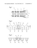 Stenting Ring with Marker diagram and image