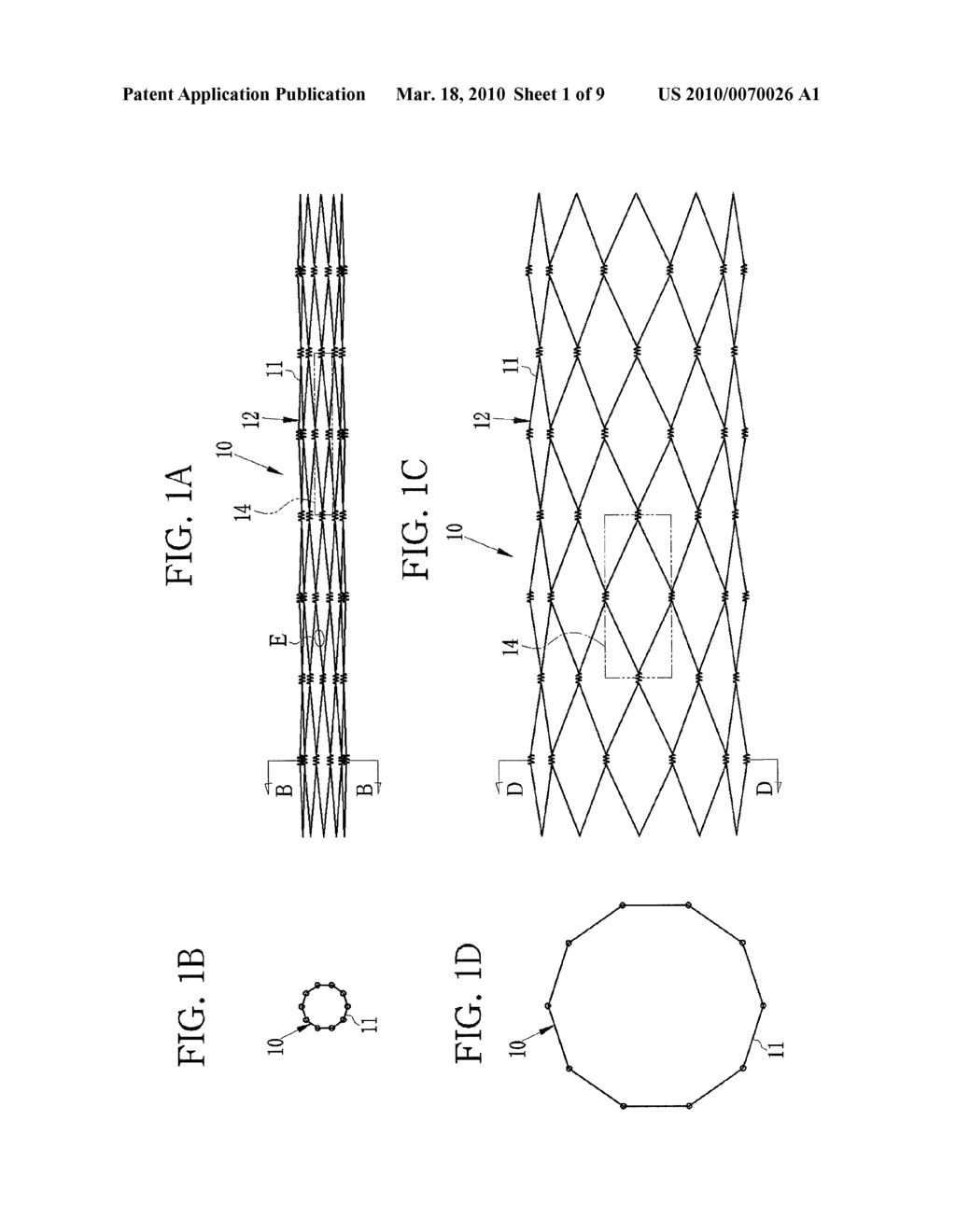STENT WITH POROUS MEMBRANE AND MANUFACTURING METHOD THEREOF - diagram, schematic, and image 02
