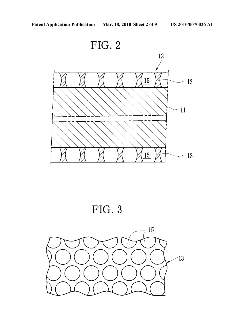 STENT WITH POROUS MEMBRANE AND MANUFACTURING METHOD THEREOF - diagram, schematic, and image 03