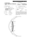 Intraocular Lens diagram and image