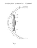 Intraocular Lens diagram and image