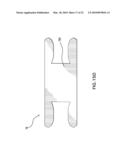 EXTENDABLE INTERVERTEBRAL DISC PROSTHESIS SYSTEM diagram and image