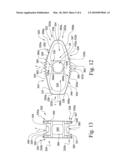 Expandable spinal implant and associated instrumentation diagram and image