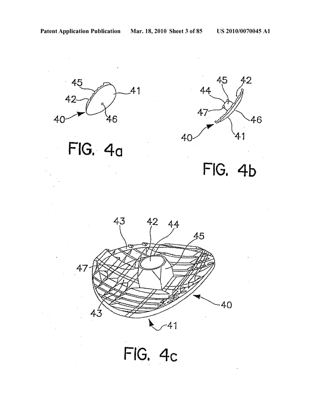 System and Method for Joint Resurface Repair - diagram, schematic, and image 04