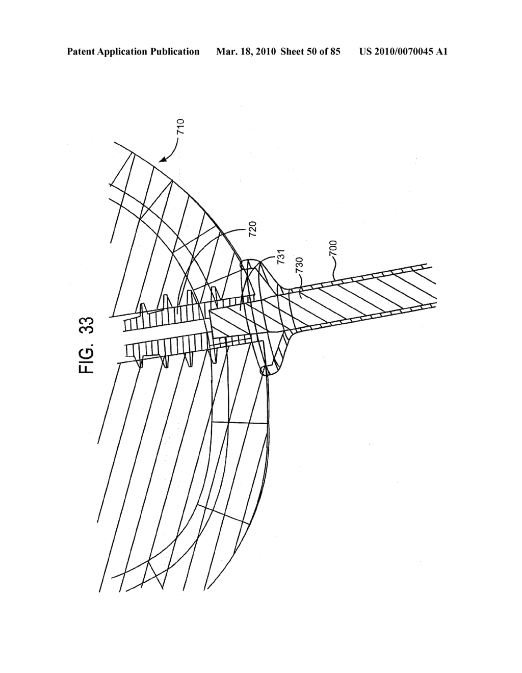 System and Method for Joint Resurface Repair - diagram, schematic, and image 51