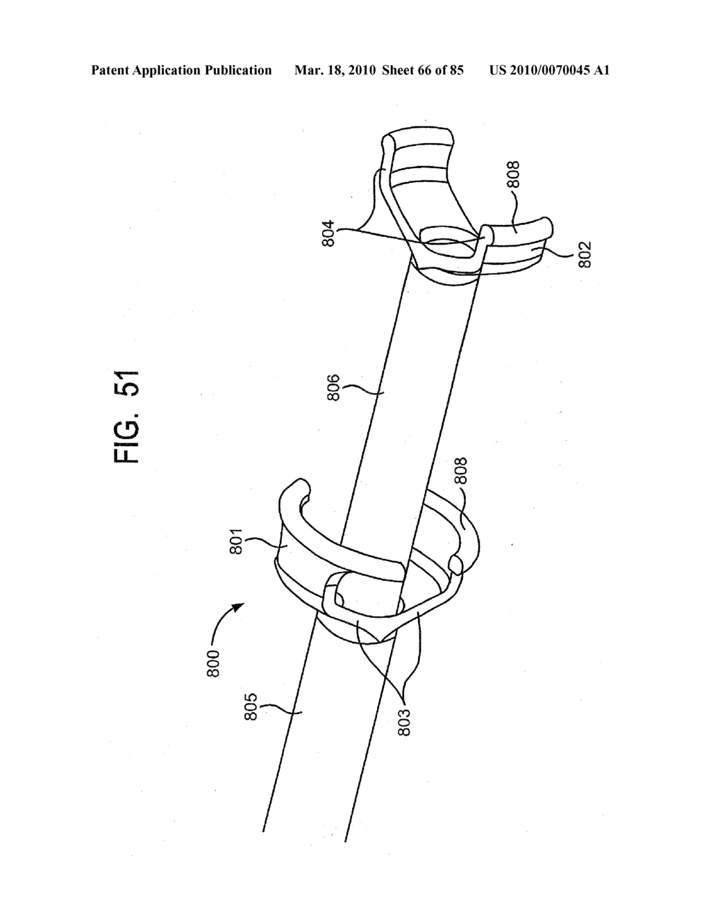 System and Method for Joint Resurface Repair - diagram, schematic, and image 67