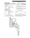 Foldable Prosthetic Implant Element diagram and image