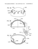 Foldable Prosthetic Implant Element diagram and image