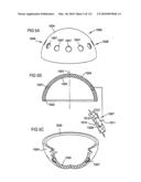 Foldable Prosthetic Implant Element diagram and image