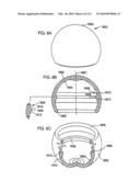 Foldable Prosthetic Implant Element diagram and image