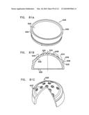 Foldable Prosthetic Implant Element diagram and image