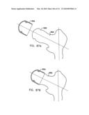 Foldable Prosthetic Implant Element diagram and image