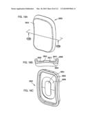 Foldable Prosthetic Implant Element diagram and image