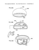 Foldable Prosthetic Implant Element diagram and image