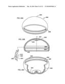 Foldable Prosthetic Implant Element diagram and image