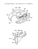 Foldable Prosthetic Implant Element diagram and image