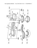 Foldable Prosthetic Implant Element diagram and image