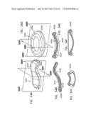 Foldable Prosthetic Implant Element diagram and image