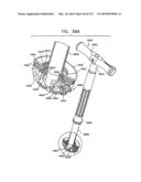 Foldable Prosthetic Implant Element diagram and image