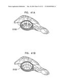 Foldable Prosthetic Implant Element diagram and image